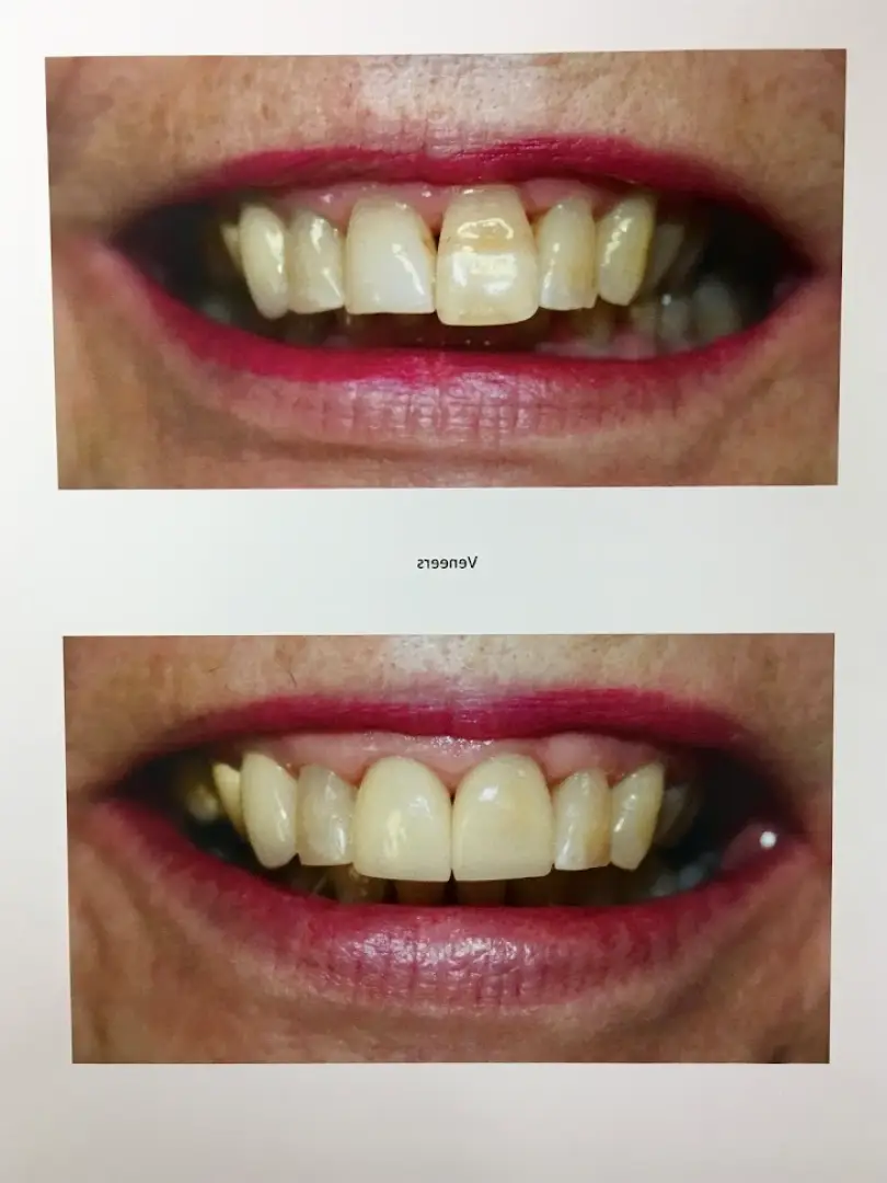 Fruitland Park Lake Harris Dental
