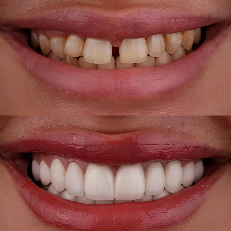 Westminster Bertagnolli Dental