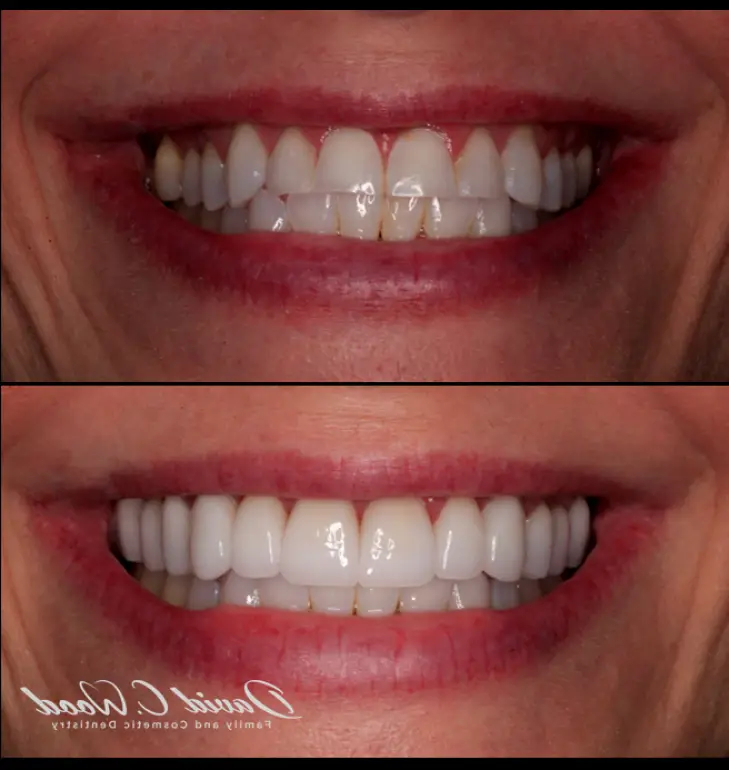 Carmel David C. Wood Family & Cosmetic Dentistry