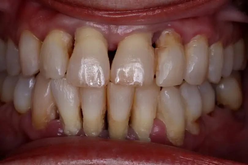  Hollywood Malo Dental Prosthodontics
