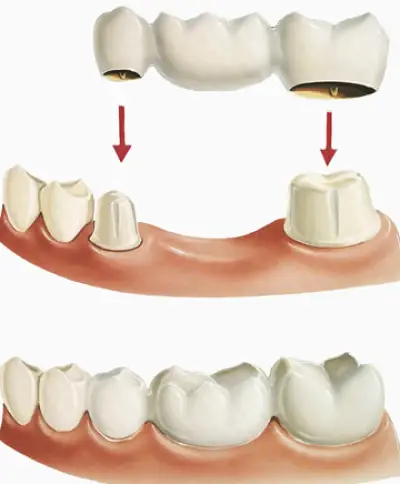 Premier Dental Center New Braunfels