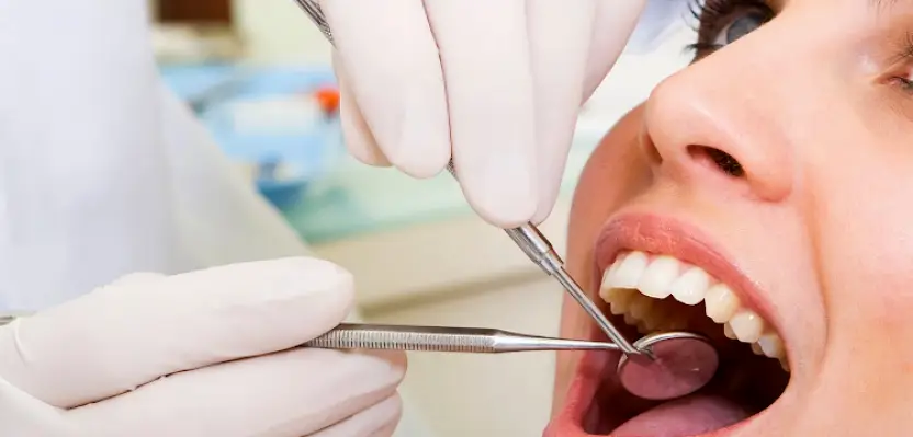 Silver Spring Michael S. Pollack DDS