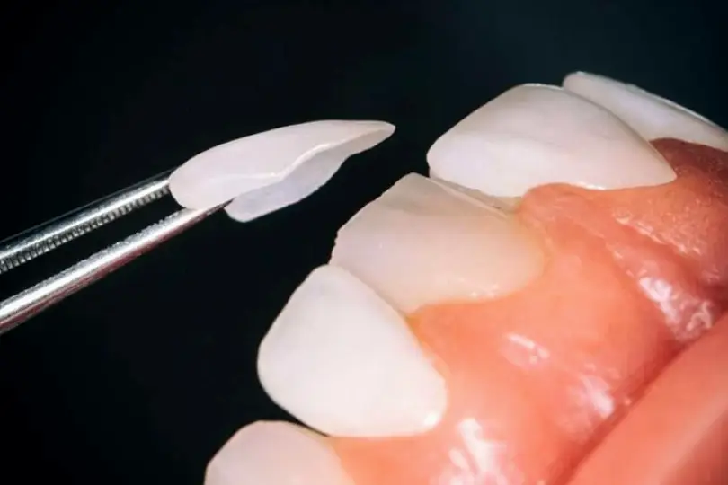 Bay Shore Long Island Dental Prosthodontics Inc
