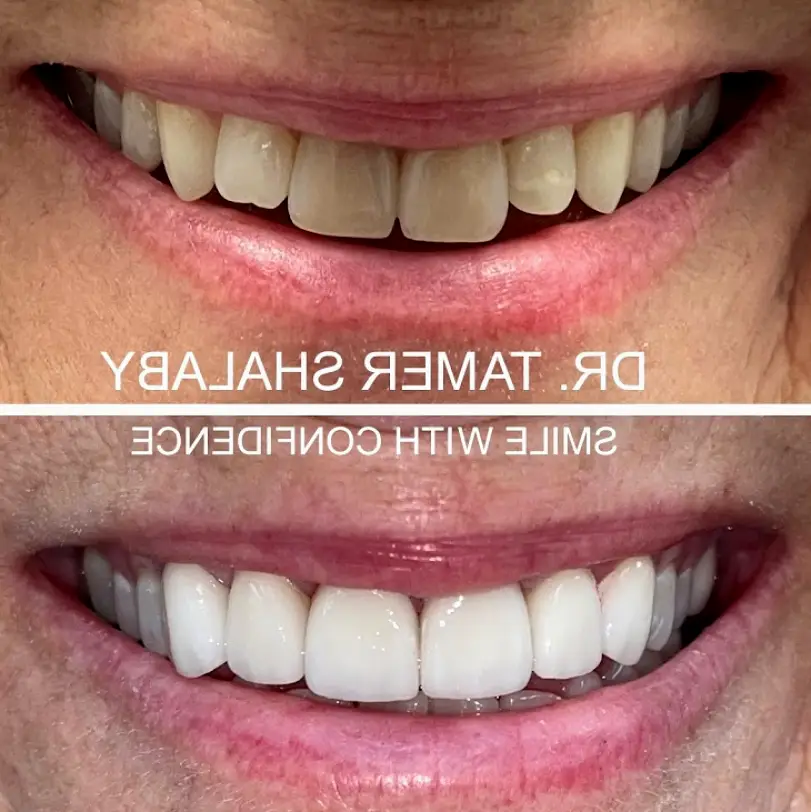 Laguna Hills Rancho Laguna Family Dentistry