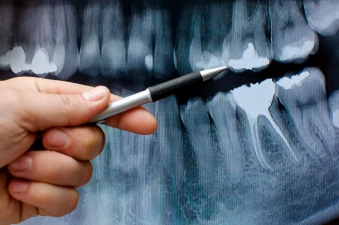 Nederland Smile Docs