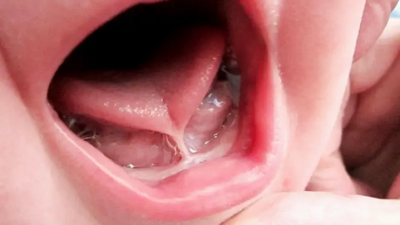 Jonesboro Center for Lip and Tongue Ties