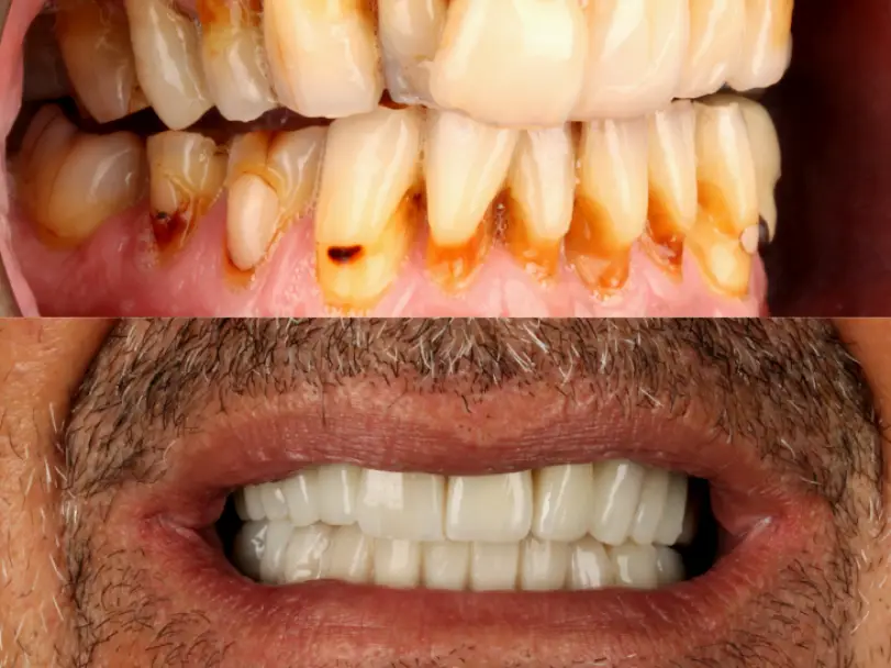 Sarasota Dentalvana