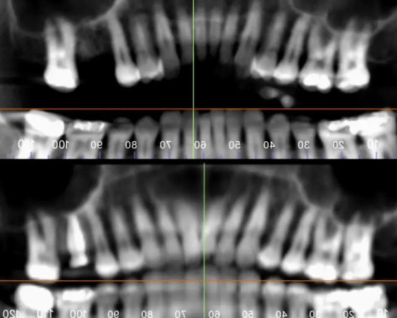 Fairmont Stahr Oral Surgery