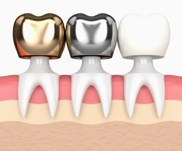 Pelham Smiles Family Dentistry