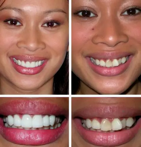 Hoover Diamond Smiles Dentistry