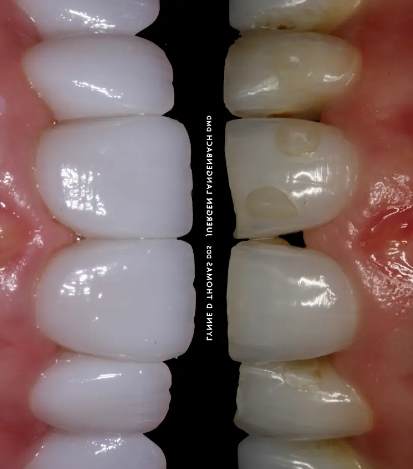 Poway Pearls of Dentistry