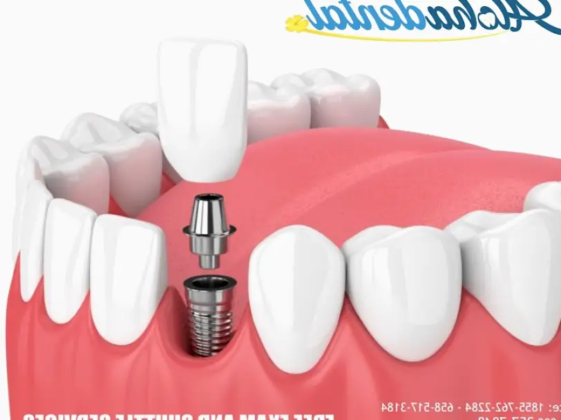 Los Algodones Aloha Dental