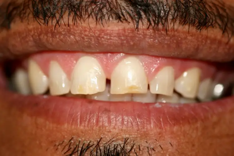 Murrieta Smiles Dentistry