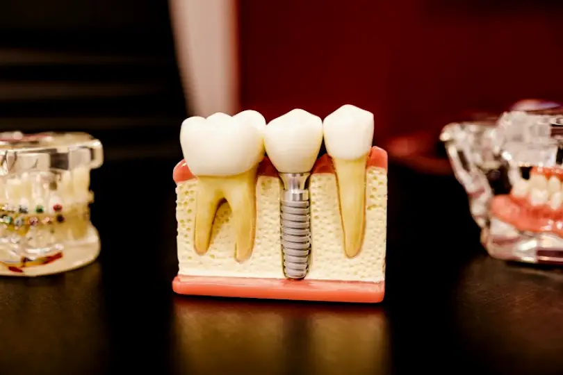 Santa Rosa Northbay Dental Care
