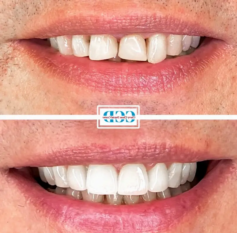 Washington Chevy Chase Dental Center