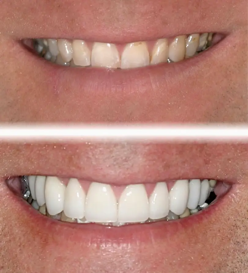 Vacaville Dr. Randy Johnson's Center for Contemporary Dentistry