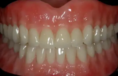 Winder removable prosthetics dental laboratory