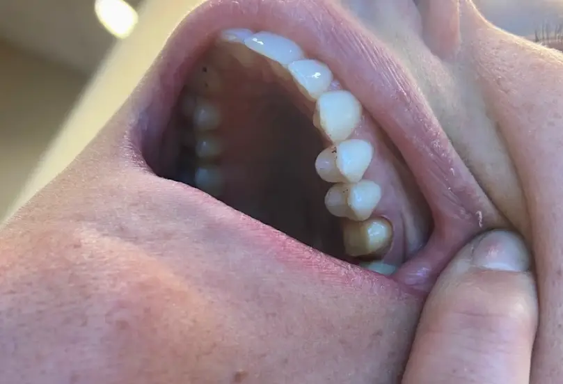  Antioch Haug Jeffrey K DDS