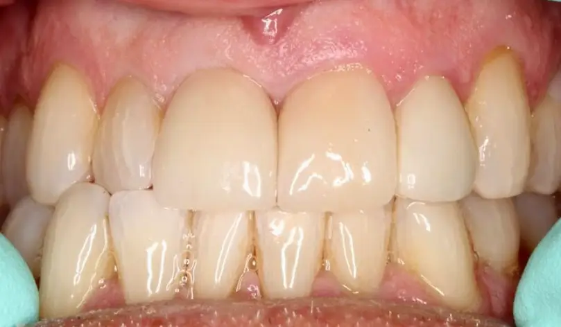 La Mesa Smiles & Implant Dentistry