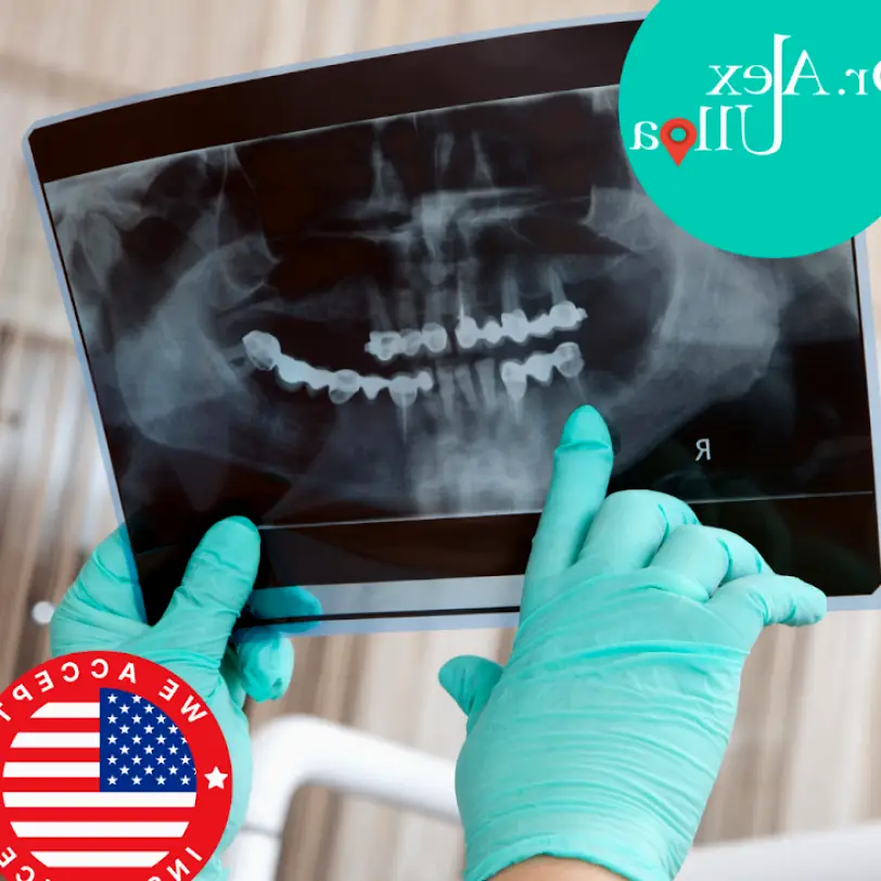 Los Algodones Dentist Algodones Mexico | Implants Crowns Zirconia | We accept Insurance Dental Ulloa