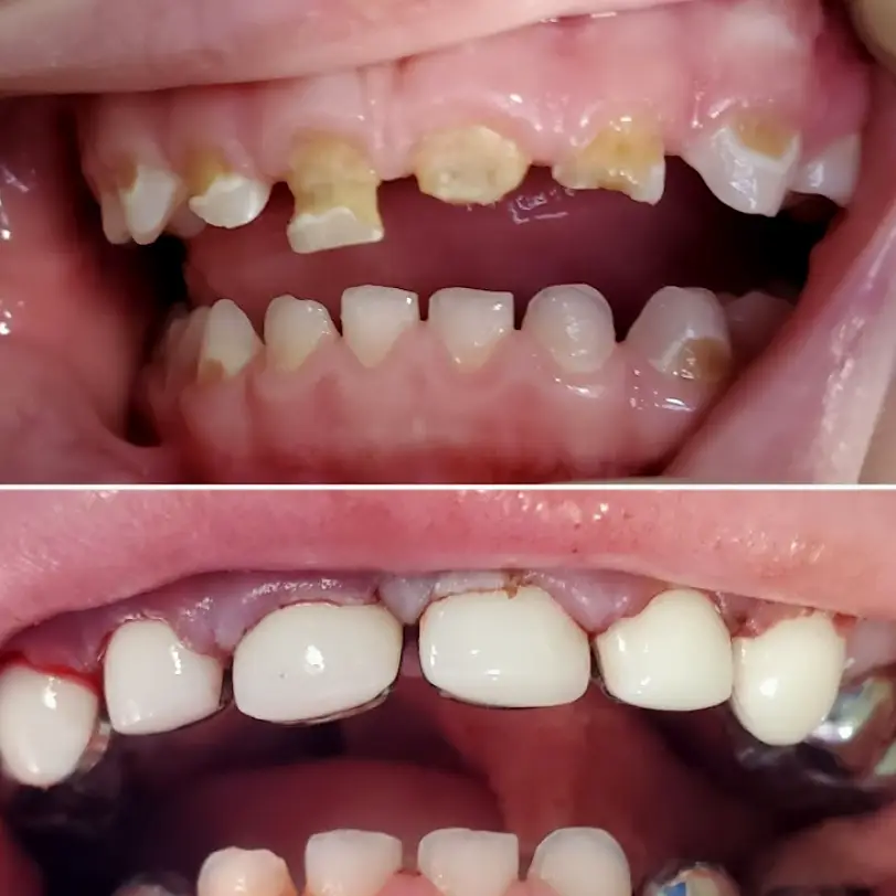 Sommerall West Hospital Pediatric Dentist