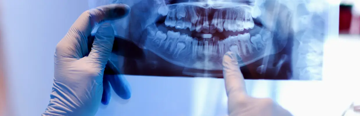 Burnt Hills Ballston Lake Family Dental