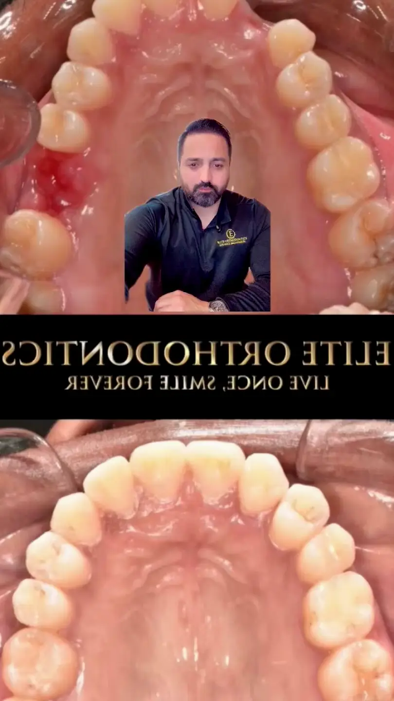 Elite Orthodontics - Woodbridge