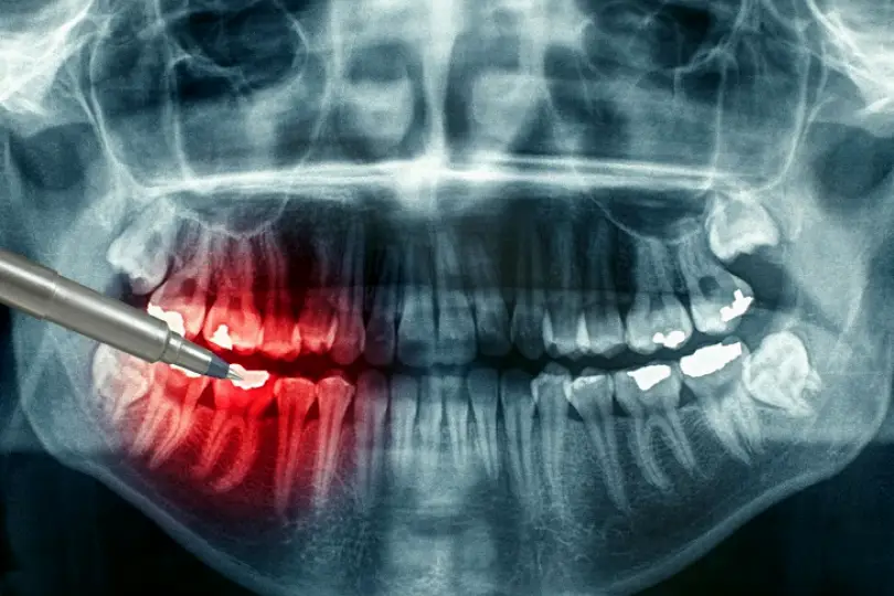 Burns Rosenzweig Orthodontics