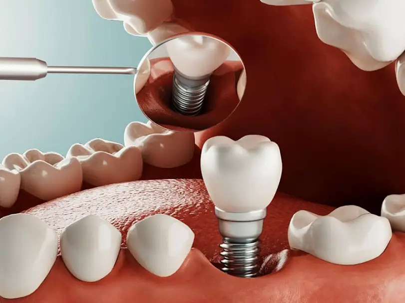 Leominster Family Dentists