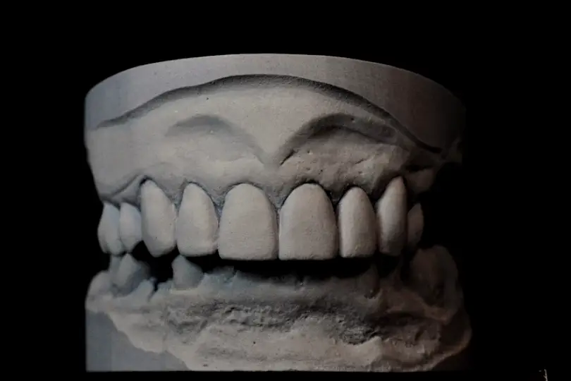 Tyler Elite Ceramics Dental Laboratory