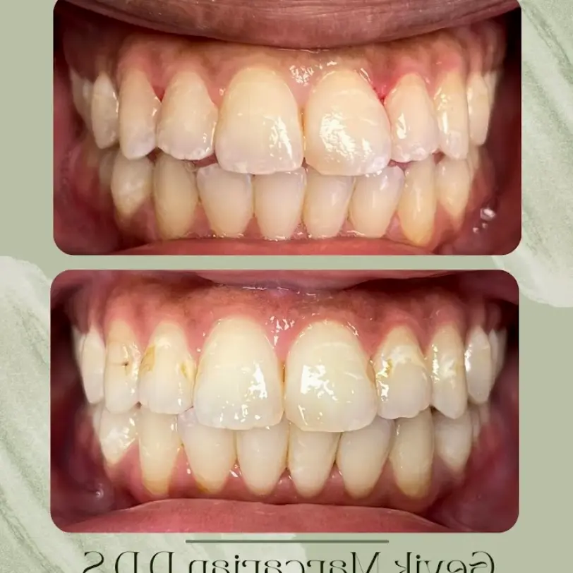 Encino Gevik Marcarian DDS