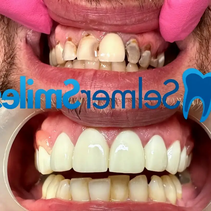 Selmer Smiles