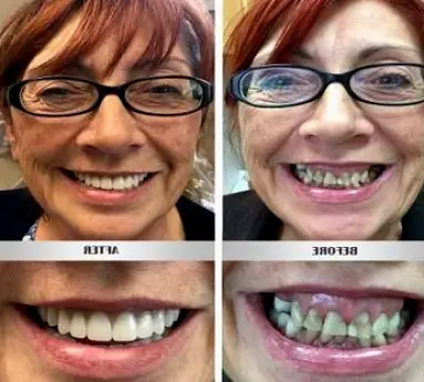 Silverdale Peninsula Prosthodontics