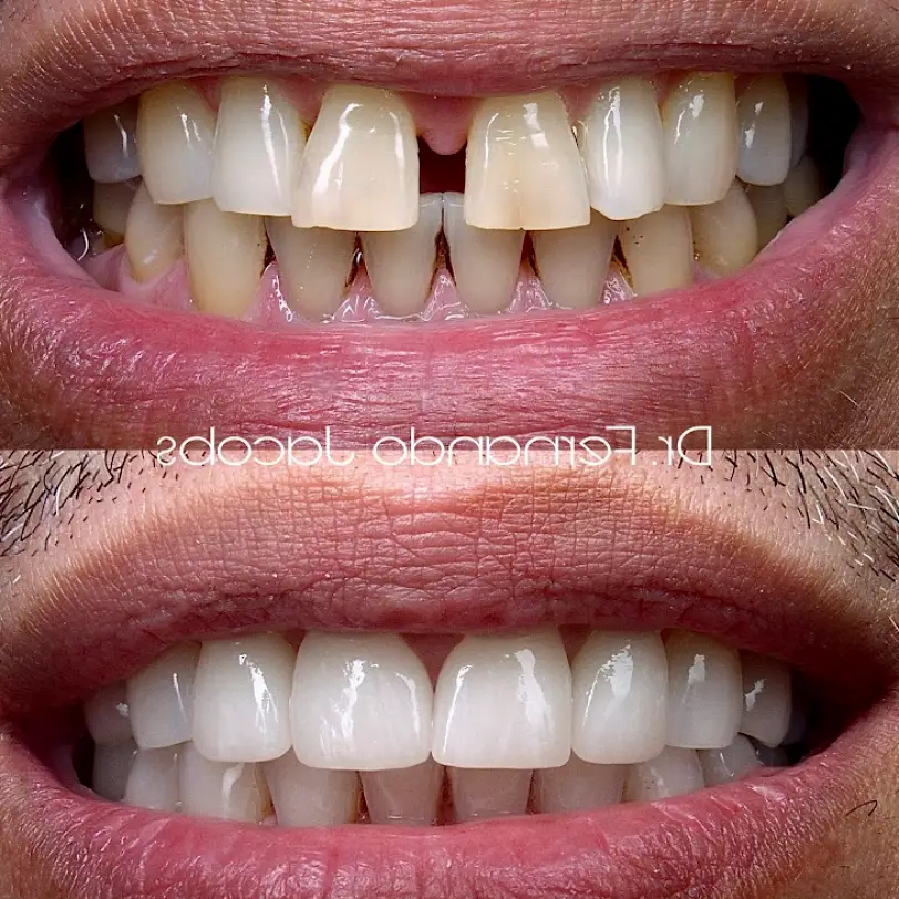  Riverside Center For Esthetic Dentistry