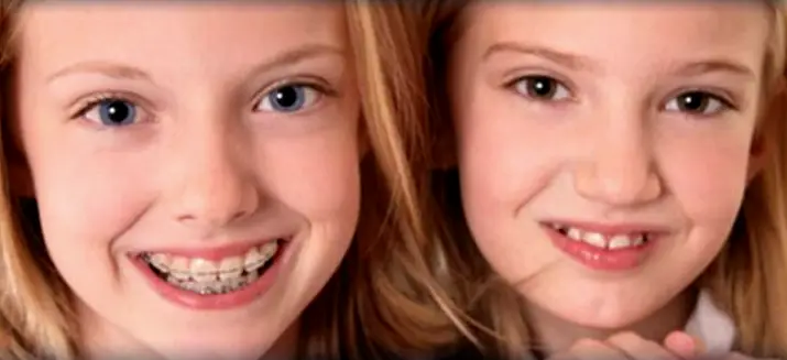 Whitestone NorthShore Orthodontics/Invisalign Center