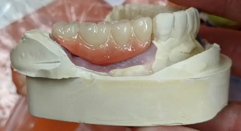 Acton Family Dental General Dentist and Emergency Dentist
