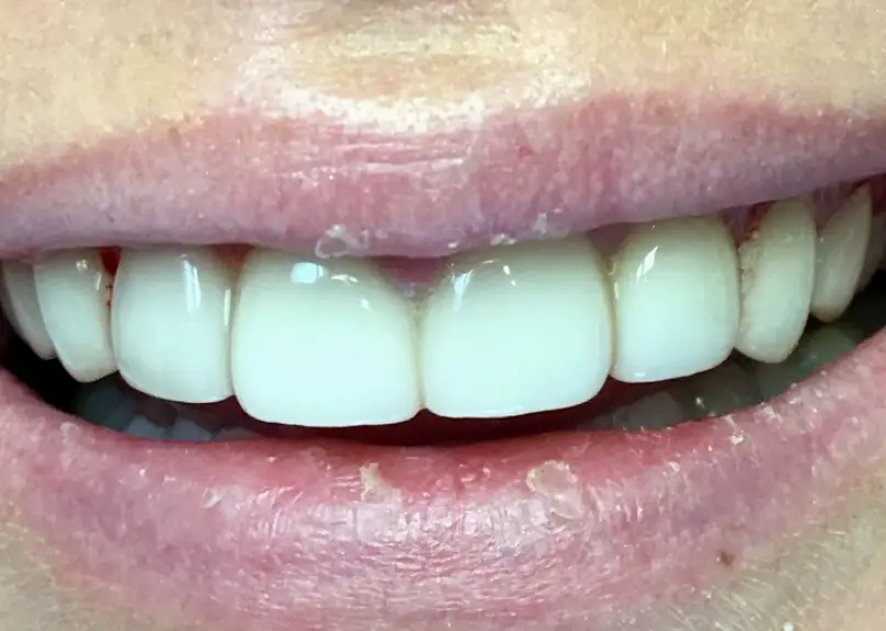 Mt Airy Dr. Jennifer R. Foster, DDS