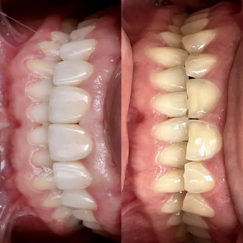 Campbell Vino Smiles Dentistry