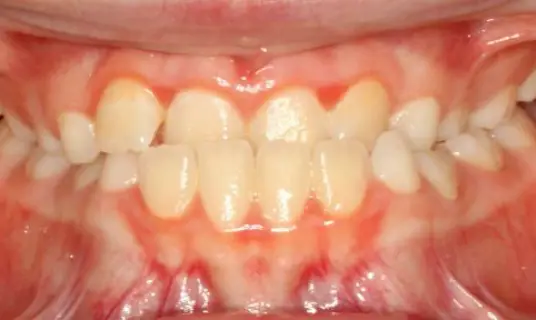 Fond du Lac Bright Orthodontics