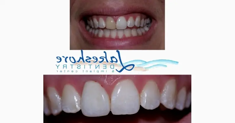 Holland Lakeshore Dentistry & Implant Center