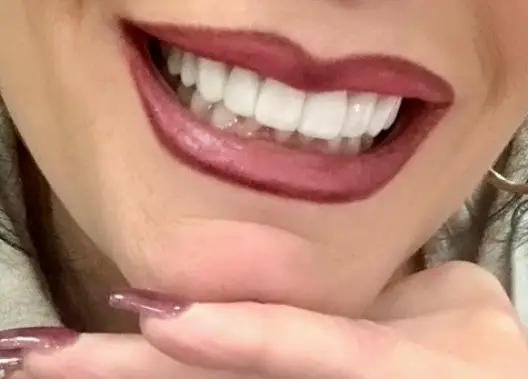 Murrieta Digital Smile Makeovers