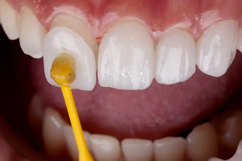 North Port Dental: Ballentine, Richard DMD