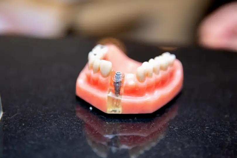 Oakbrook Terrace Periodontal Medicine & Surgical Specialists