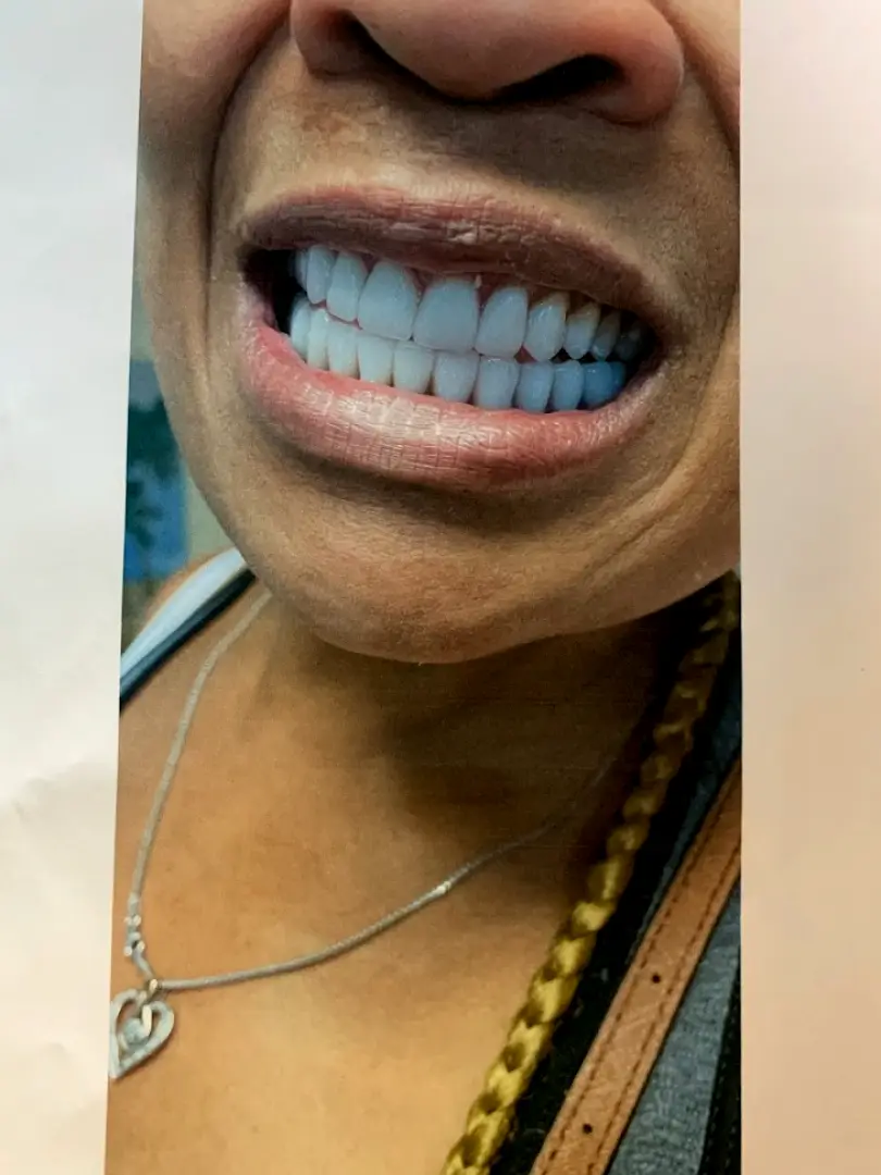 Atlanta AApoLLo Dental Centers