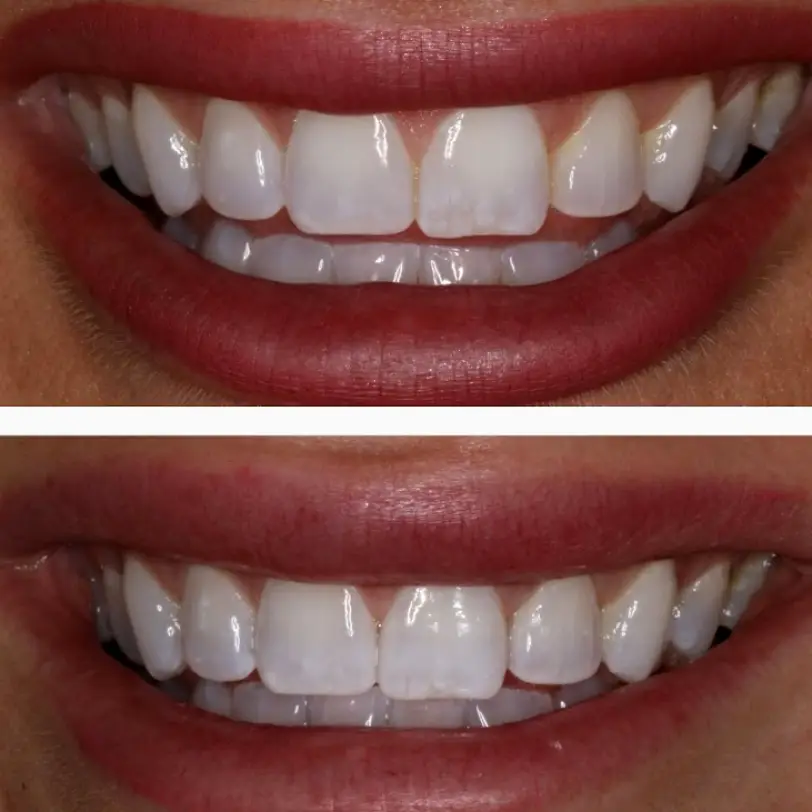 Kingsport Colonial Heights Dental Group. Susan Burks Creech, DDS