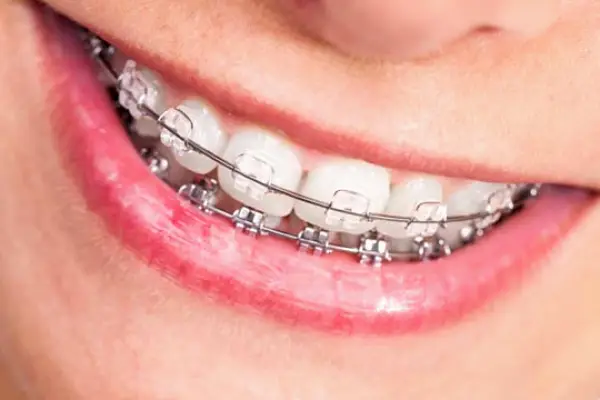 Laurinburg Henry Orthodontics