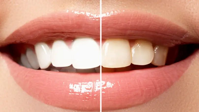 Lebanon Advanced Denture Care Center