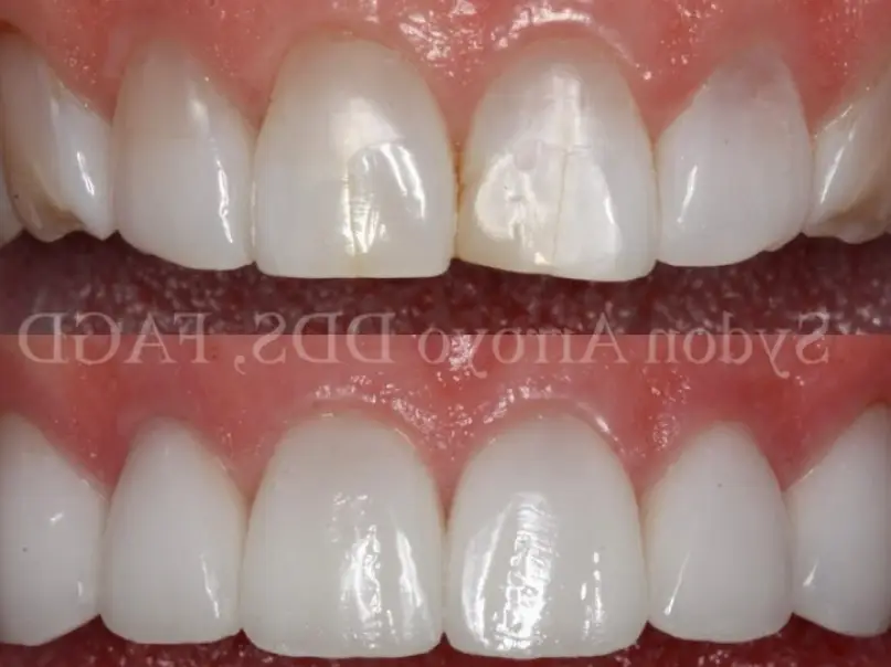 Torrance Skypark Dental Professionals - Sydon Arroyo, DDS, APC