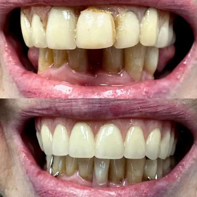 Howell Sincere Smiles Dental