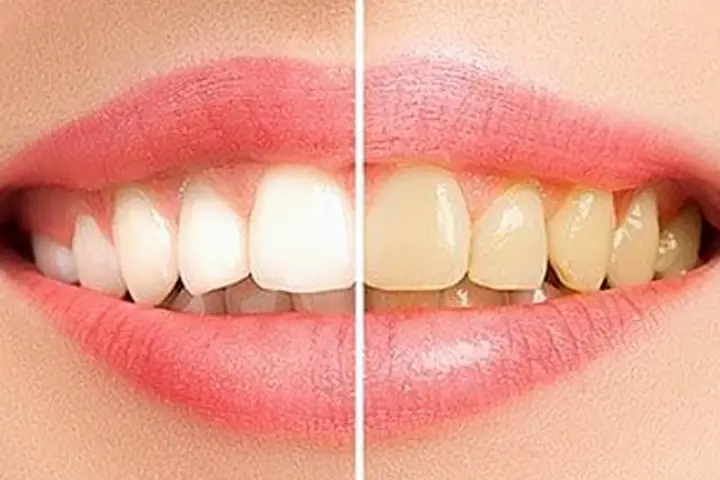 Dyer Peterson Family Dental